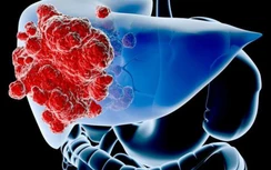 Người đàn ông 34 tuổi mắc ung thư gan: Sáng ra tuyệt đối không làm việc này