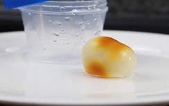 Viên sỏi mật giống như ngọc, bác sĩ nói: “Chỉ có 1 người trong vạn người”