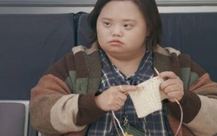 Nữ diễn viên phim "Our Blues" mắc hội chứng Down, triệu chứng bệnh thế nào?