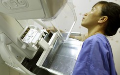 Sốc vì gái chưa chồng đã mắc ung thư vú