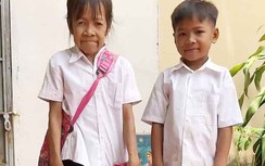 Bé gái 10 tuổi có gương mặt nhăn nheo như bà lão 60 vì mắc bệnh lạ