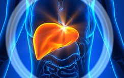 7 loại "nước thần" làm giảm xơ gan, ung thư gan bác sĩ khuyên nên uống hằng ngày