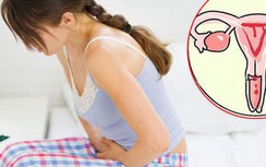 Cô gái 19 tuổi sốc vì chưa từng quan hệ tình dục vẫn mắc ung thư cổ tử cung