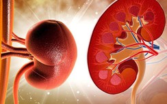 9 "thần dược" rẻ tiền cứ ăn nhiều là khỏi lo sỏi và ung thư thận