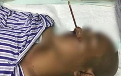 Ngoáy mũi bằng đũa, người đàn ông nhận cái kết đắng