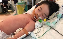 Cậu bé 4 tuổi bị sốt và đau chân không ngờ lại nhiễm “vi khuẩn ăn thịt”