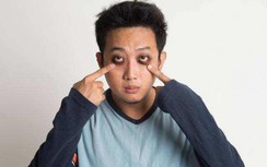 Quầng thâm ở mắt không chỉ do thức khuya mà còn là dấu hiệu của những bệnh sau