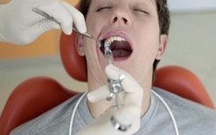 Chàng trai tử vong khi đi nhổ răng khôn và 4 nhóm người cần đặc biệt cần chú ý