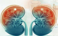 Trắc nghiệm: 2 quả thận quý giá sẽ được bảo vệ nếu bạn không hiểu sai những điều này