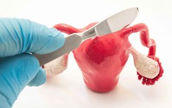 Những hành vi âm thầm phá hoại tử cung, phụ nữ nên tránh xa