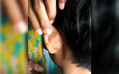 Không làm bài tập về nhà, cậu bé bị cô giáo bấm ghim vào tai