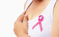 Chuyên gia điểm mặt những loại ung thư tấn công phụ nữ Việt
