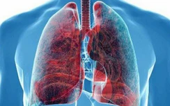 15 dấu hiệu những bệnh ung thư nguy hiểm nhất thường bị quý ông coi nhẹ