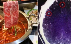 Không nấu chín thịt đúng cách khi ăn lẩu, người đàn ông bị nhiễm ký sinh trùng não