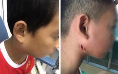 Vụ vi khuẩn Whitmore ăn mòn cơ thể: Đã có kết quả điều tra vụ 3 chị em ruột tử vong