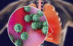 Bất ngờ với 12 thứ là "sát thủ" của phổi mà rất ít người biết