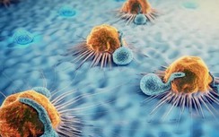 Những biểu hiện điển hình của 21 loại ung thư, cần làm gì để phòng tránh