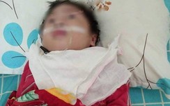 Bệnh nhi bị teo não sau phẫu thuật, người nhà tố bệnh viện tắc trách