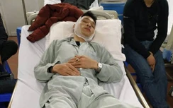 Sức khỏe tài xế bị chém toác đầu sau va chạm giao thông ở Quốc Oai ra sao?