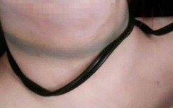 Bắt đối tượng siết cổ người đàn ông sống một mình trong nhà