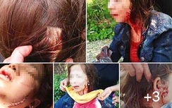 Níu kéo bất thành, chồng dùng mảnh chai rạch mặt và cổ vợ