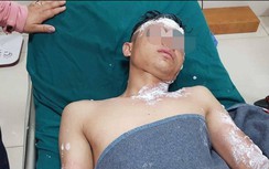 Số ca tử vong do TNGT giảm 22%, cấp cứu do pháo nổ tăng 32%