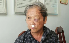 Đã có kết quả giám định thương tích PV VTV ở Kon Tum bị đánh