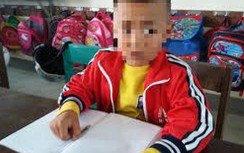 Giáo viên tát học sinh lớp 1 chảy máu tai bị kỷ luật