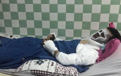 Vì sao anh trai Việt kiều bị tạt axit vội vã rời khỏi Việt Nam?