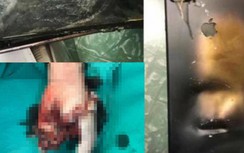 Cụt tay, hỏng mắt vì nổ điện thoại Iphone khi vừa dùng vừa sạc