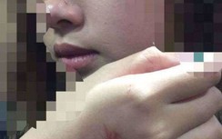 Cô gái trẻ bị sàm sỡ trong thang máy chung cư cao cấp, xử lý thế nào?