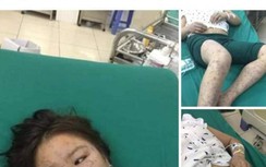 Xuất hiện tin đồn thất thiệt về dịch tả lợn Châu Phi: Đề nghị xử lý nghiêm