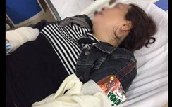 Chó chạy rông gây tai nạn chết người: Chủ nuôi có thể bị phạt tù 5 năm