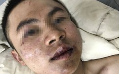 Đến nhà "con nợ" đòi tiền, thanh niên bị đánh nhập viện