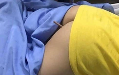 Bạn nghịch dại, bé trai 9 tuổi bị bút chì đâm xuyên mông phải nhập viện