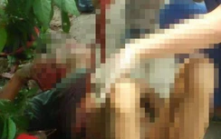 Người đàn ông nghiện rượu tự đâm vào bụng, buộc phải cắt 1,8m ruột