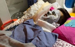 Công bố số điện thoại tiếp nhận thông tin, nhận dạng kẻ tạt axít Việt kiều