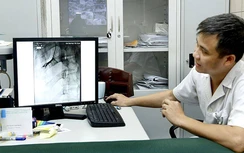 Sốc ma túy, người trẻ cũng dễ bị nhồi máu cơ tim