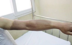 Nổ bóng bay trang trí tại chùa Ba Vàng, 4 người nhập viện