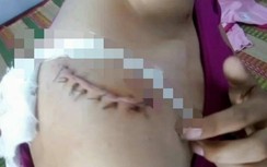 Lời kể hãi hùng của người phụ nữ bị chồng cũ chém ở Sóc Trăng