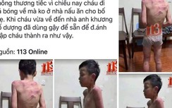 Xác minh thông tin bé trai bị bố dượng đánh bầm tím người
