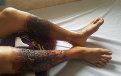 Hải Phòng: Công an điều tra vụ đổ trộm hóa chất ra mương nước