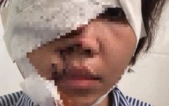 Thiếu úy công an đã chuẩn bị rất kỹ trước khi tạt axít vợ sắp cưới