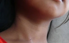 Khởi tố gã hàng xóm U60 dâm ô bé gái 7 tuổi ở Bạc Liêu