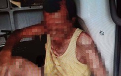 Tự tưới xăng rồi châm lửa đốt: Con trai tử vong, bố bỏng nặng