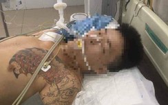 Bị can 17 tuổi nhập viện nguy kịch, người nhà kéo đến bệnh viện