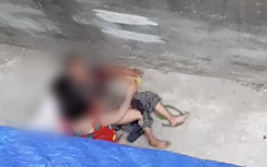 Sang nhà cháu ngoại chơi, cụ bà 76 tuổi bị chó cắn nhập viện cấp cứu