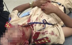 Gã đàn ông choảng cục bê tông vỡ đầu đại úy CSGT Hà Nội có nhiều tiền án