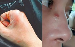 Ngô Thanh Vân thương tích đầy mình khi đóng phim Hollywood