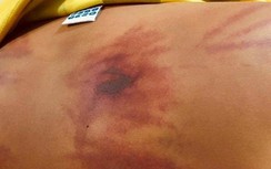 "Thầy tu" bị tố đánh dã man bé trai 11 tuổi ở Bình Thuận nói gì?